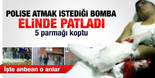 Polise atmak istediği bomba elinde patladı