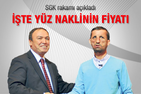 SGK yüz nakli için 46 bin lira ödeyecek