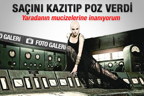 Deniz Uğur da saçlarını kazıttı - Foto Galeri