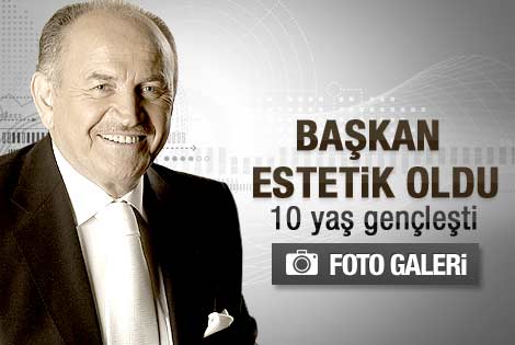 Kadir Topbaş yeni görüntüsüyle şaşırttı