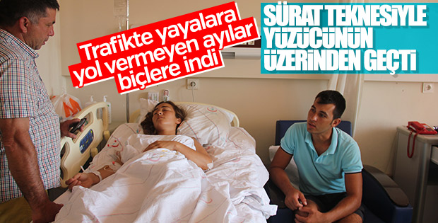 Yüzerken üzerinden tekne geçen kadın ağır yaralandı