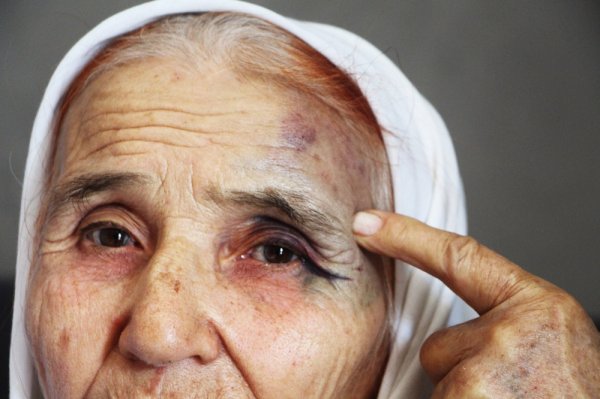 80 yaşındaki kadın eski gelininden dayak yedi