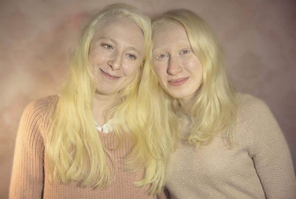 Albinizmin anlatıldığı Kar Taneleri'ne uluslararası ödül