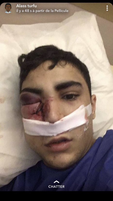 8 polisin saldırdığı genç bir gözünü kaybetti