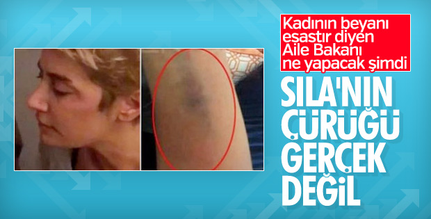 Sıla'nın Adli Tıp raporu