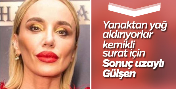 Gülşen'in yüzündeki değişiklik