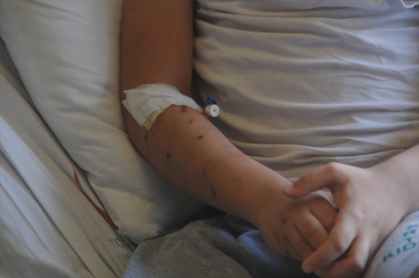 Mardin'de 4 köpek 7 yaşındaki çocuğa saldırdı
