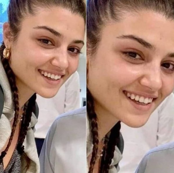 estetiksiz hali hande erçel
