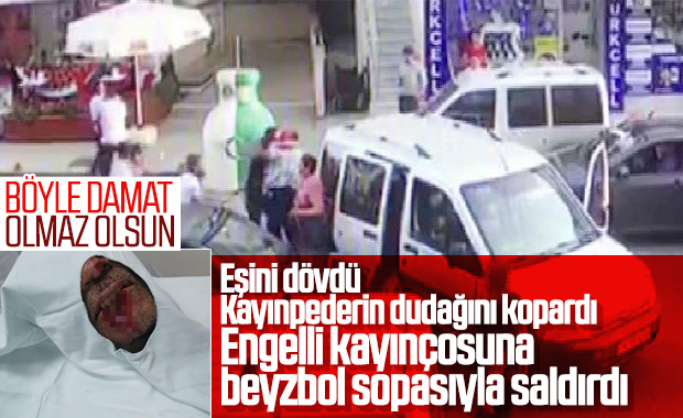 Pendik'te damat kayınpederinin dudağını parçaladı