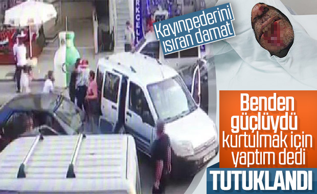 Kayınpederinin dudağını ısıran damat tutuklandı