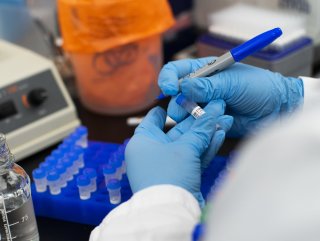 Koronavirüs test sonuçları e-Nabız'da