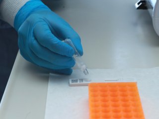 15 dakikada sonuç veren tanı kitinin kullanımına başlandı