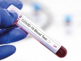 Koronavirüs tahlil bilgilerini gizliyen iki laboratuvara soruşturma