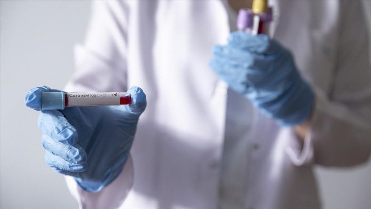 Türk bilim insanı koronavirüsü izole etti