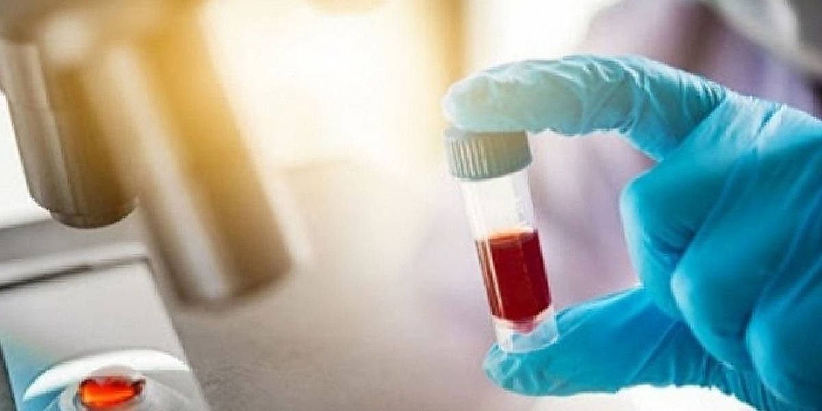 What is antibody testing #2
