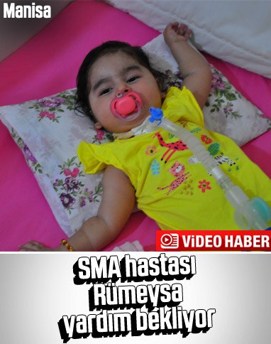 SMA hastası Rümeysa bebek yardım bekliyor