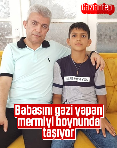 Gaziantepli Emir, gazi babasını yaralayan mermiyi kolye yaptı