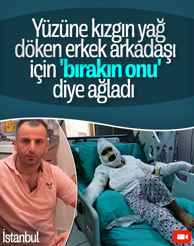 İstanbul'da yüzüne kızgın yağ attığı erkek arkadaşı ceza aldı, kadının tepkisi pes dedirtti