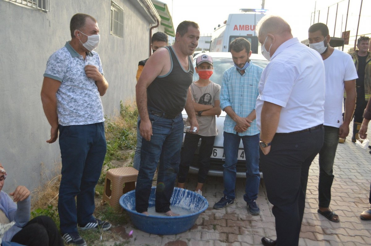 The boy chained to his feet was rescued from the fire in Bursa # 6