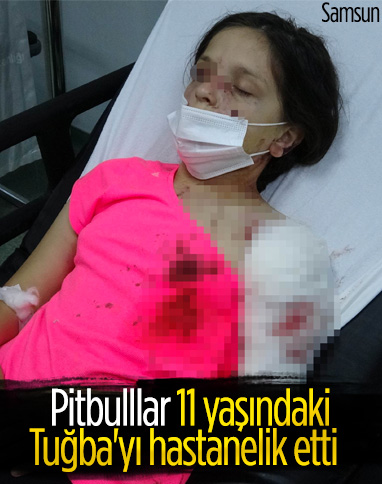Samsun'da pitbull cinsi köpekler, 11 yaşındaki Tuğba'ya saldırdı