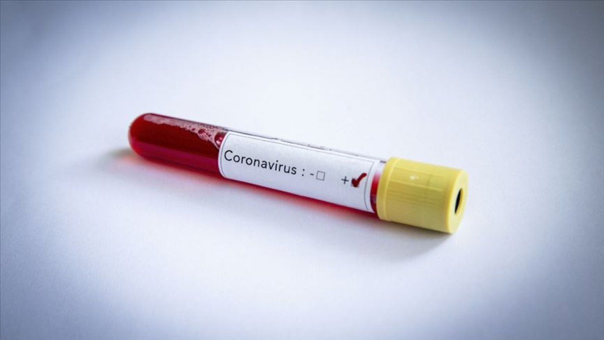 Gana'da koronavirüse yakalananların yüzde 98,5'i sağlığına kavuştu
