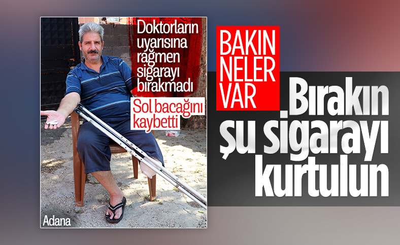 Adana’da sigara yüzünden bacağını kaybeden adam: Beni ibret alın