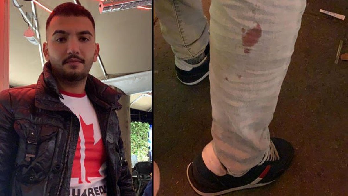 Turkish man injured in Vienna attack recounts what happened # 1