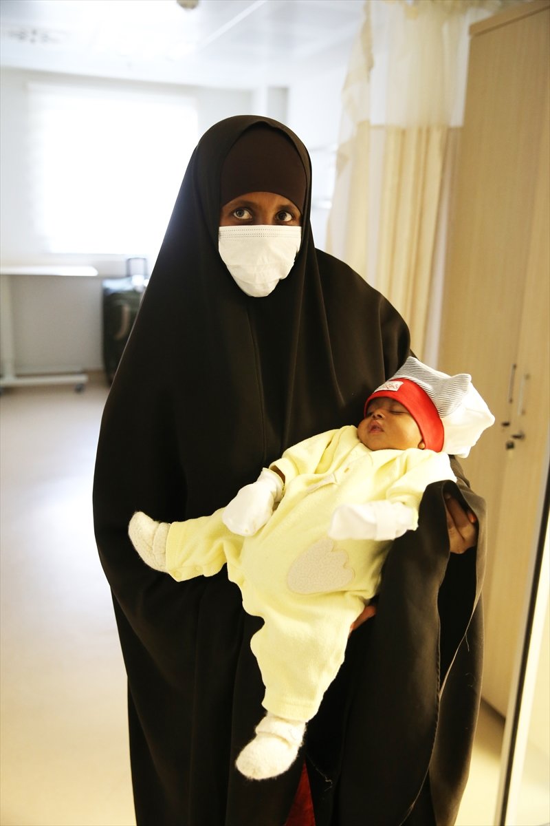 Somali baby born with 4 legs found the cure in Turkey #3