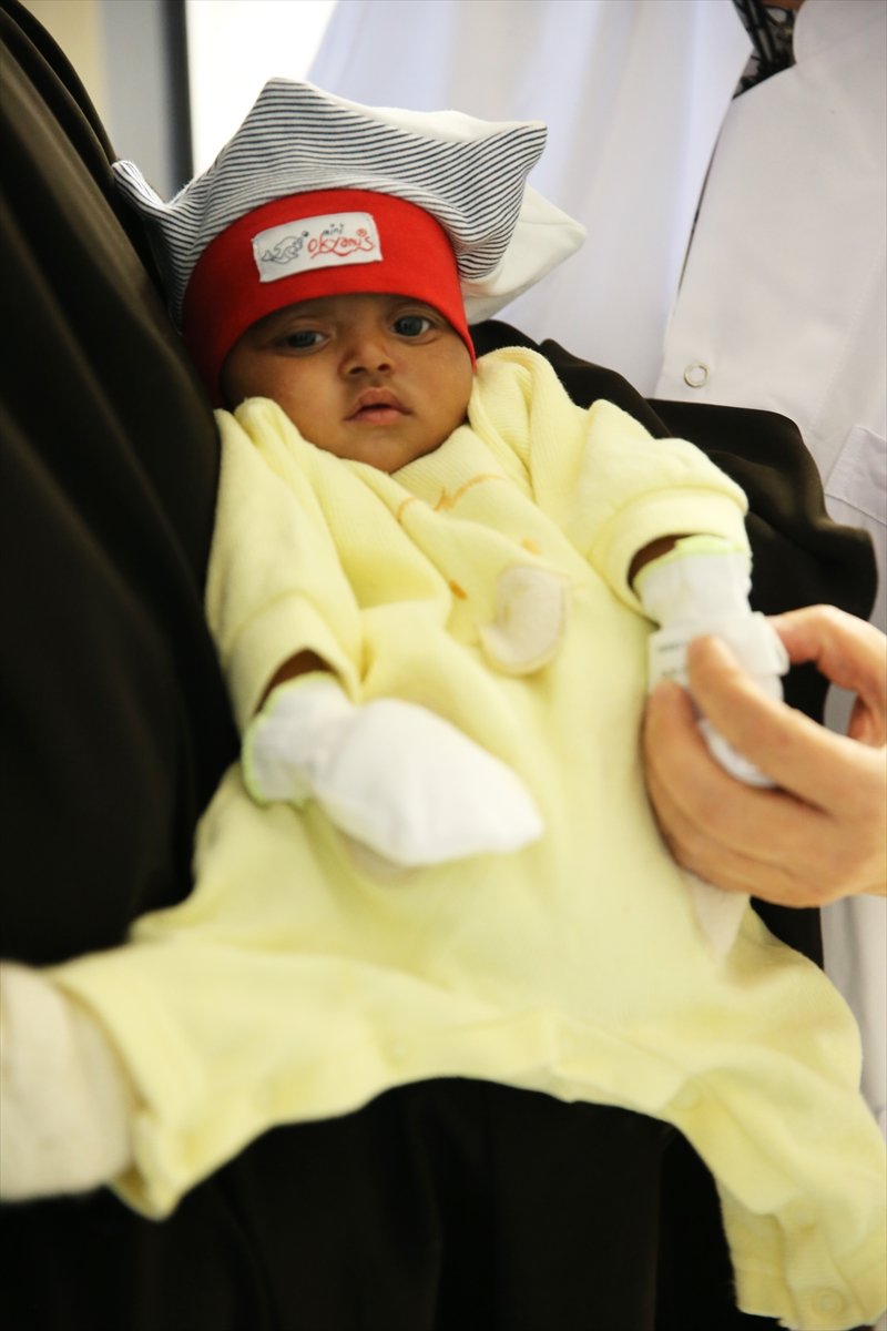 Somali baby born with 4 legs found the cure in Turkey #4