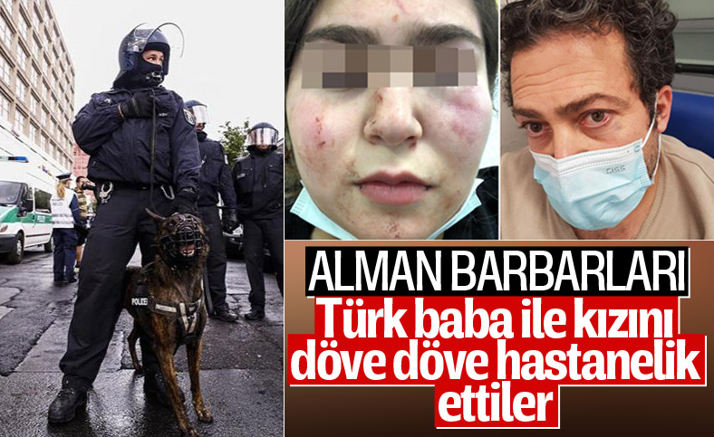 Alman polisinden Türk baba ile kızına şiddet