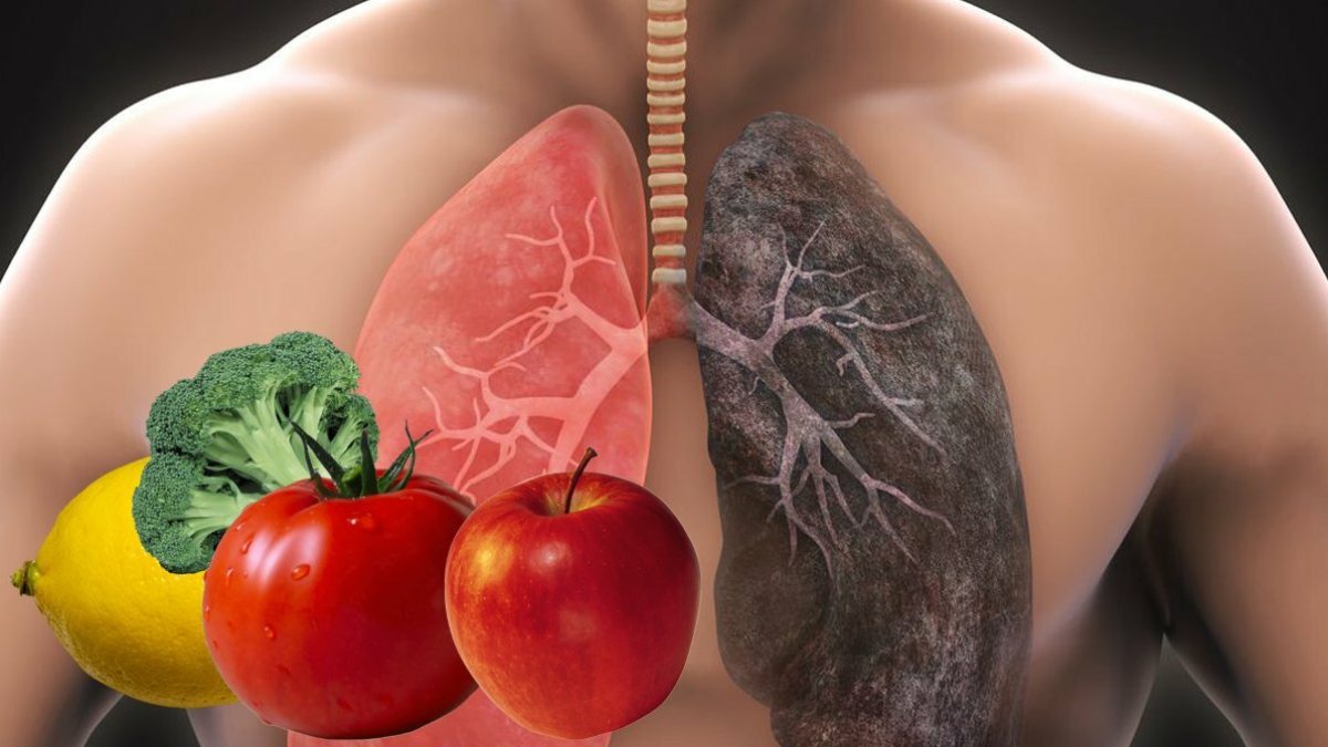 Beta carotene increases lung cancer risk Kimdeyir