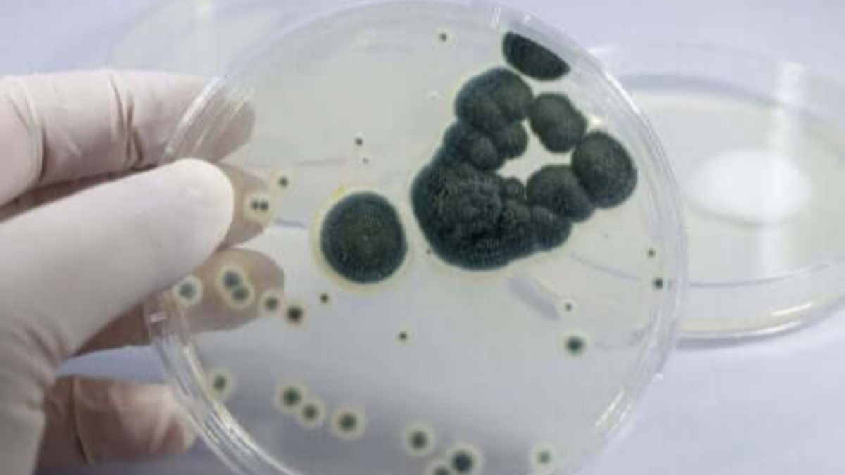 What is penicillin allergy, what are the symptoms? How is penicillin