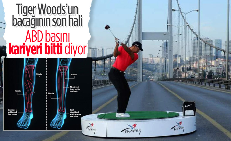 Trafik kazası geçiren Tiger Woods ameliyata alındı