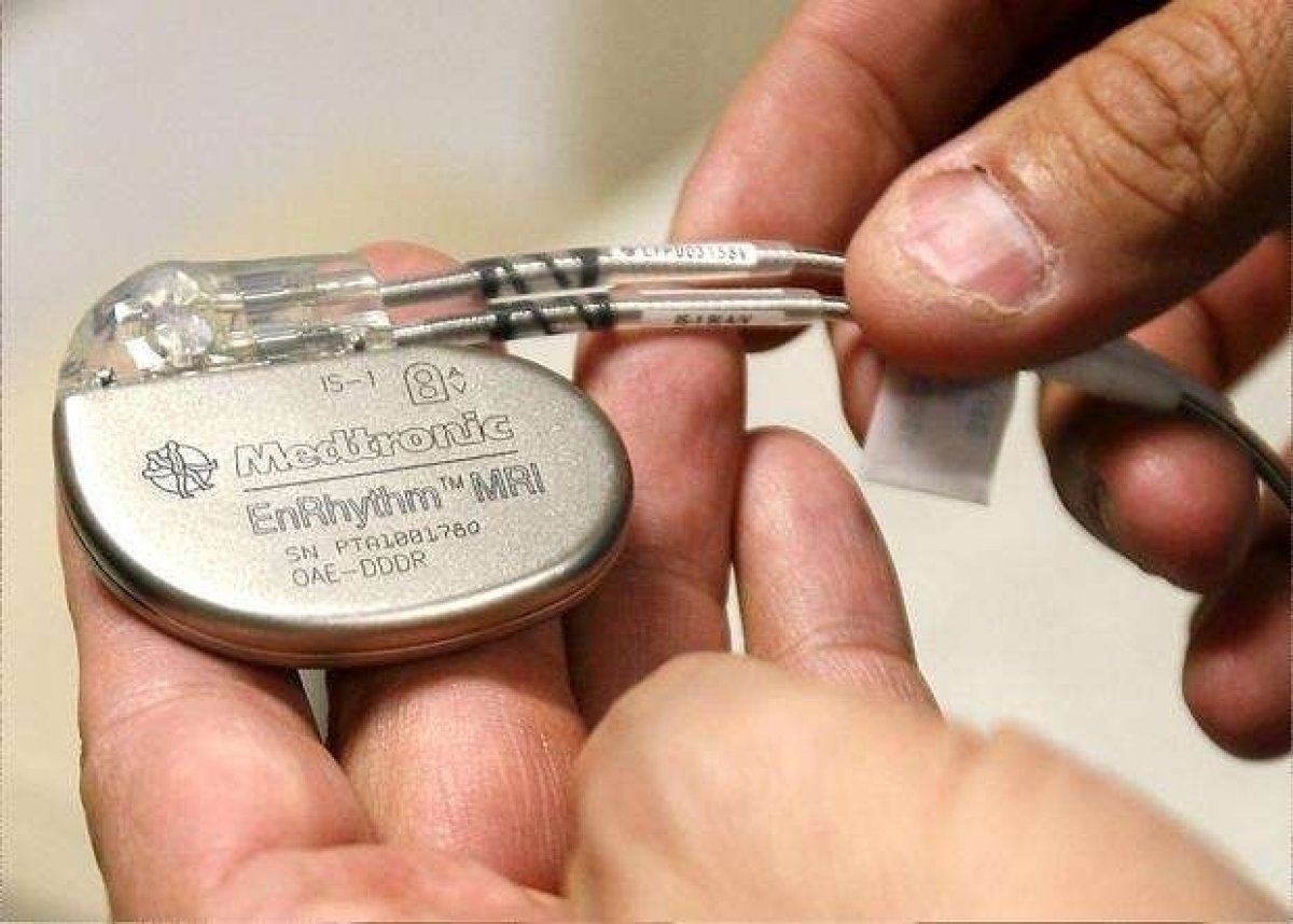   What is a pacemaker and what does it do?  Why and how is a pacemaker inserted?  #2nd
