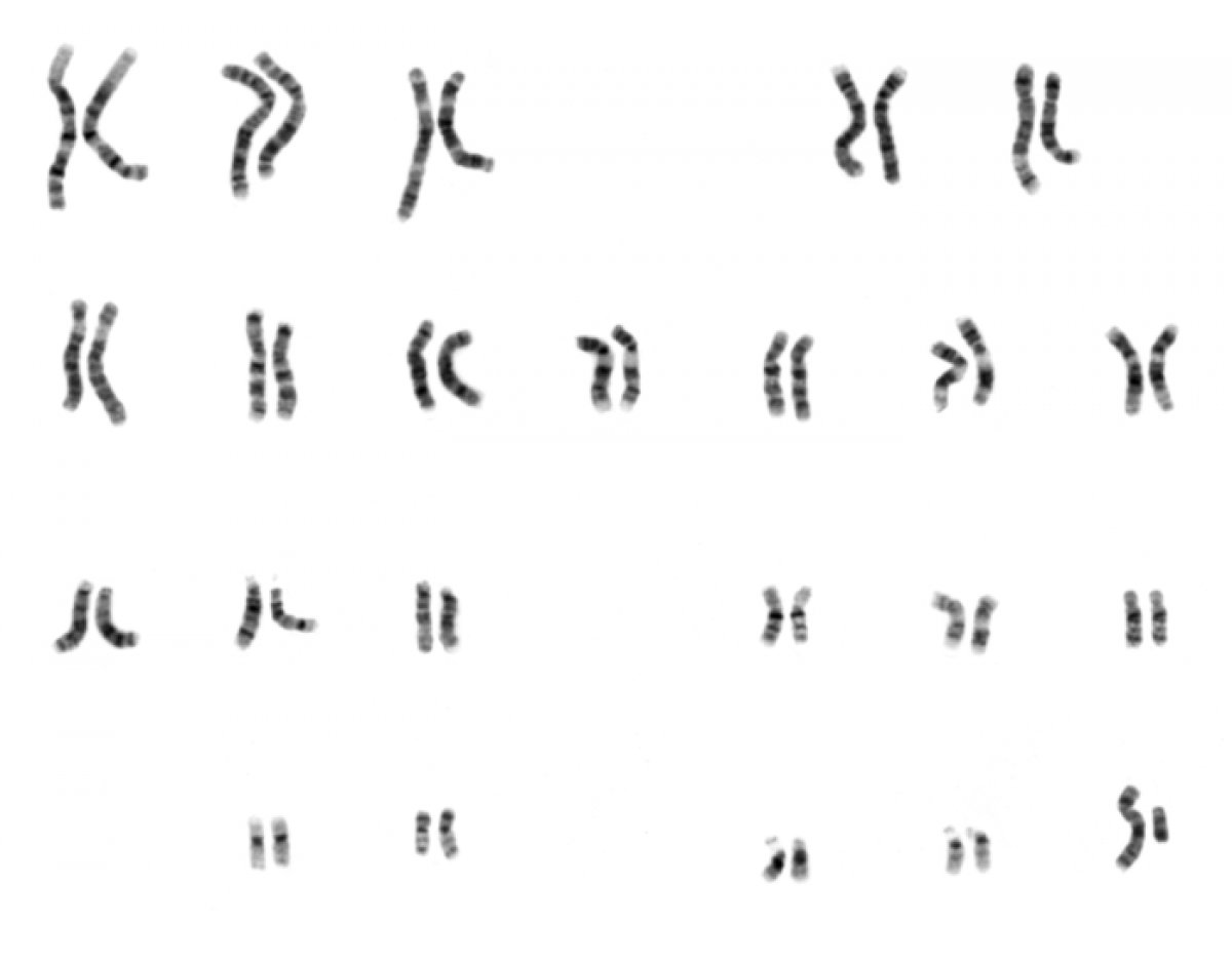 What is karyotype analysis #2