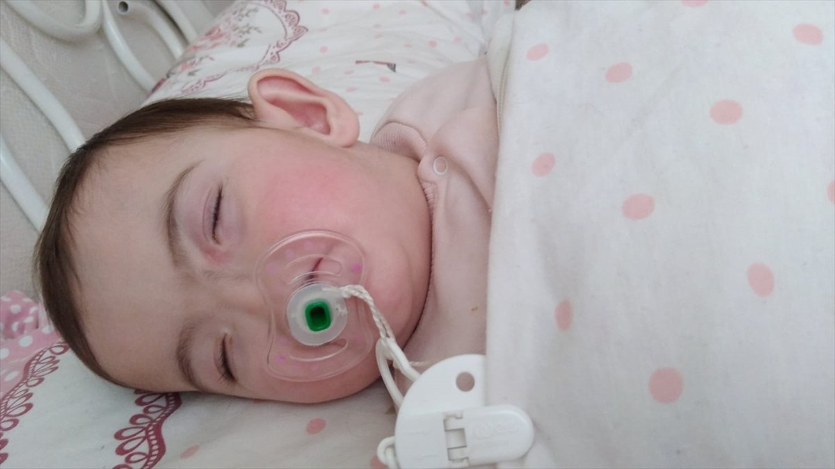 Antalya family hopes for support for their children born without a nose # 7