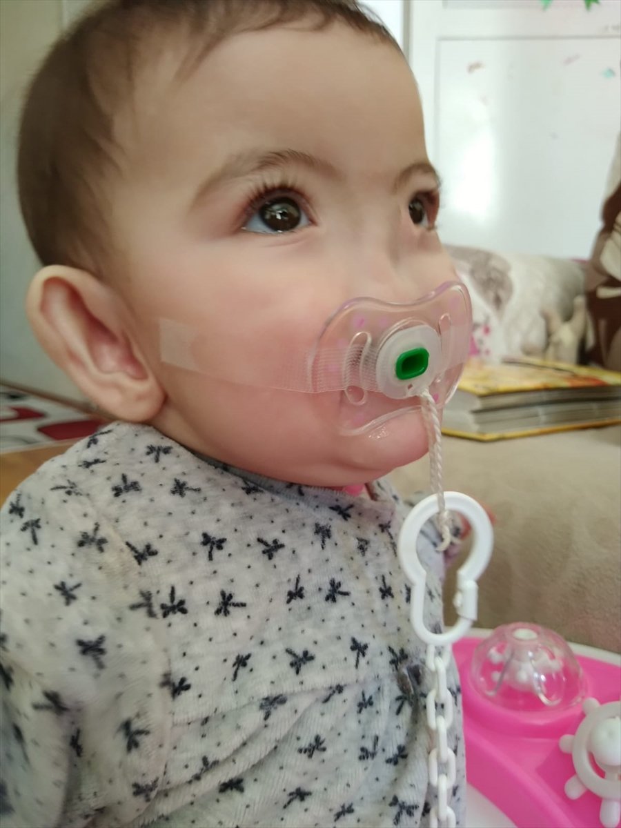 Antalya family hopes for support for their children born without a nose # 8