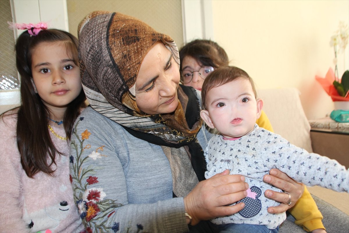 Antalya family hopes for support for their children born without a nose # 5