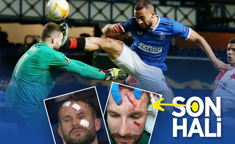 Slavia Prag kalecisi Kolar'ın son hali