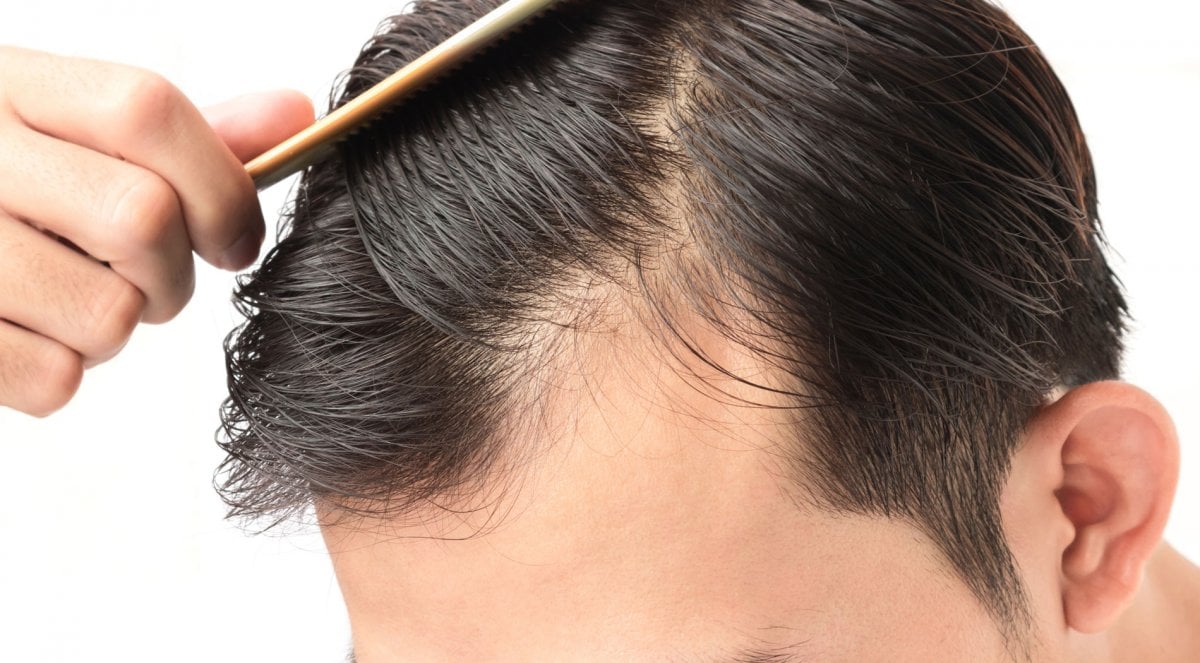 10 foods that prevent hair loss #11