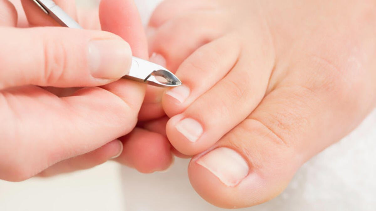 10 effective ways to get rid of ingrown toenail pain #2