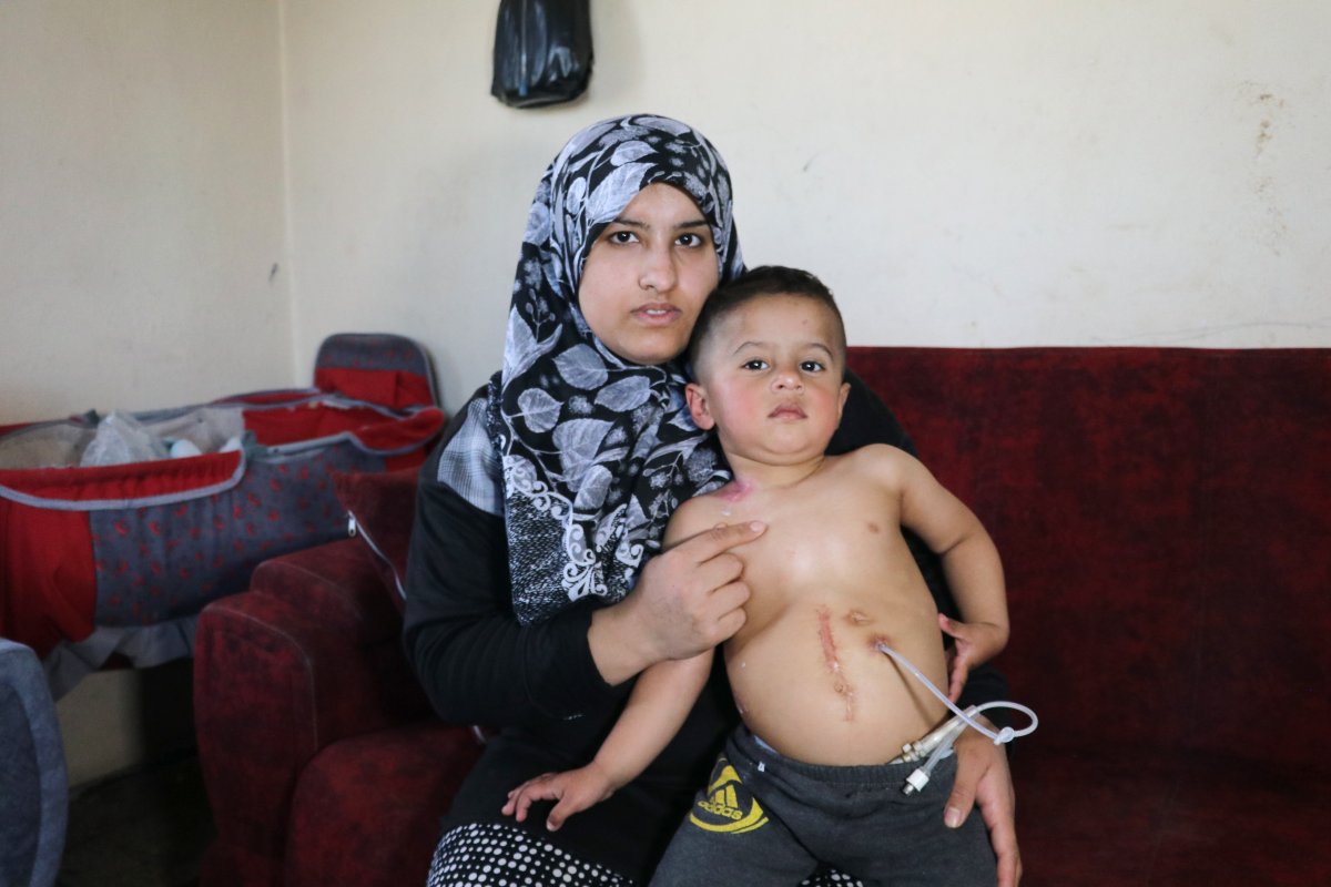 Mohammed, who has no esophagus in Adana, is waiting for help #2