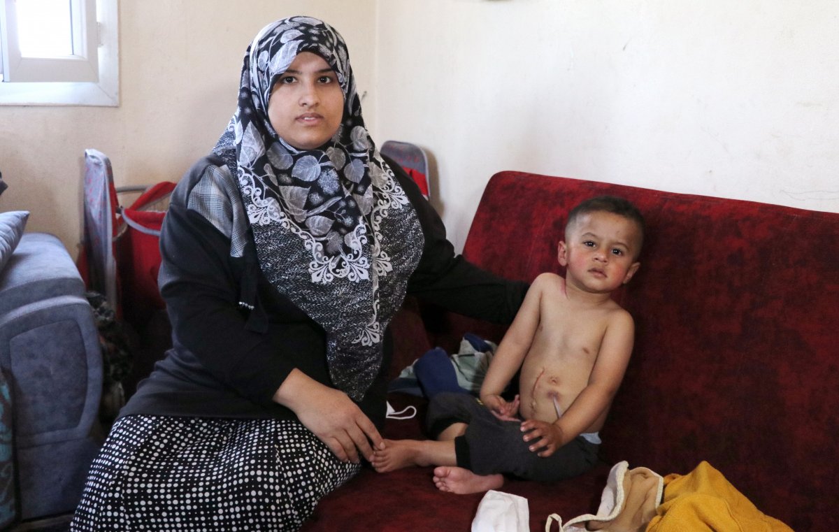 Mohammed, who has no esophagus in Adana, is waiting for help #3