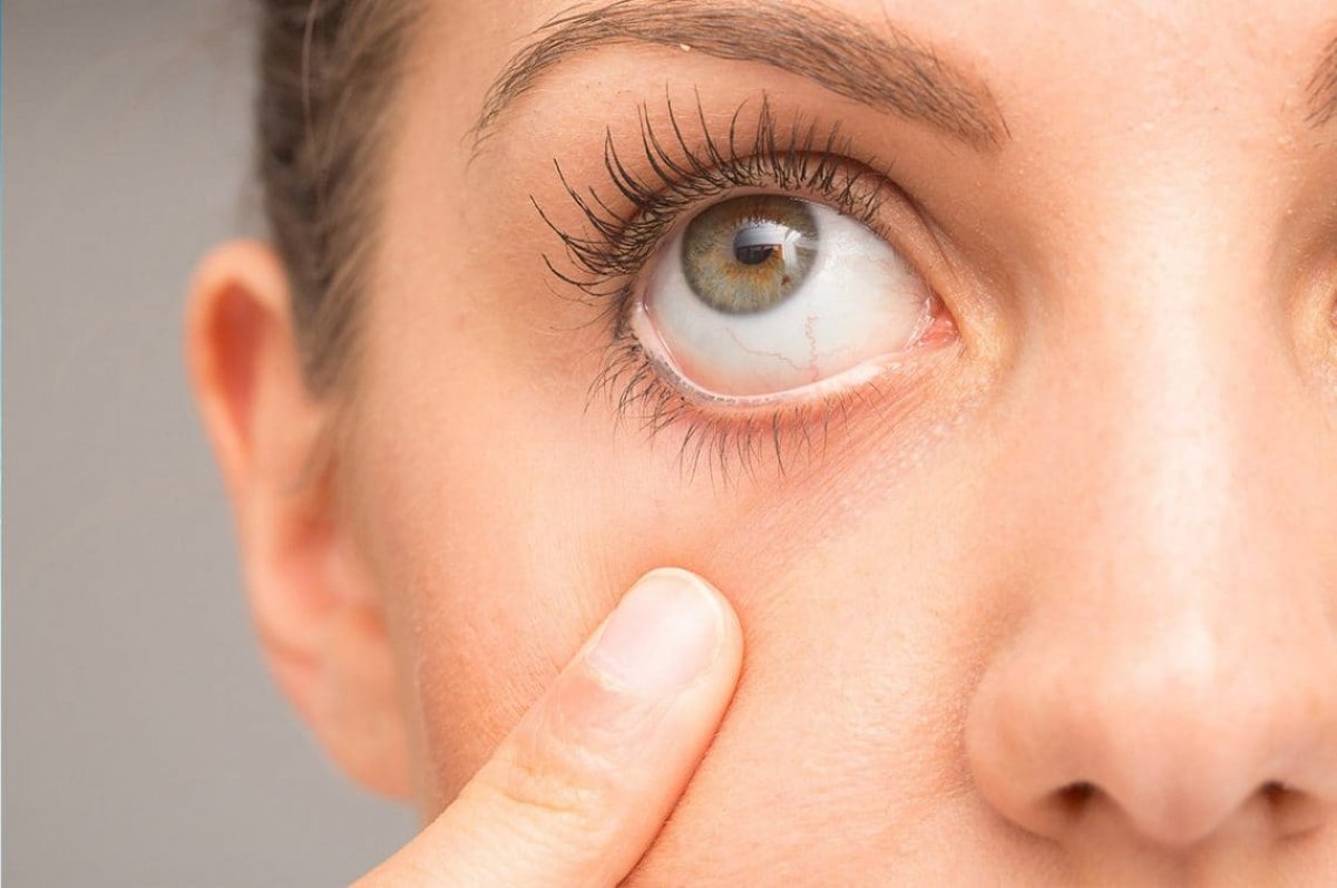 12 signs that you should go to the eye doctor #9