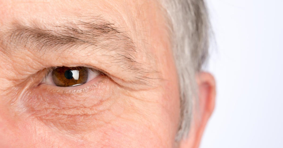 Yellow spot disease can lead to permanent vision loss Kimdeyir