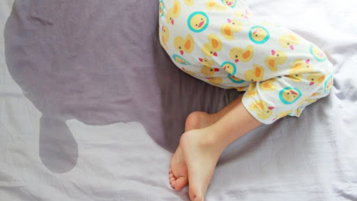 Bedwetting during sleep: What is Enuresis Nocturna?  Enuresis Nocturna causes and treatment.. #2