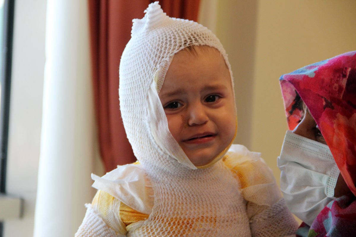 Erzurum'da bebeğin üzerine kaynar süt döküldü
