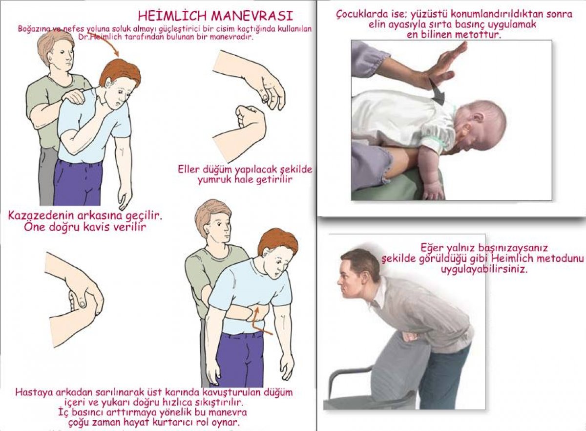 Boğulma anında Heimlich manevrası nasıl yapılır? Heimlich manevrası resimli anlatım..