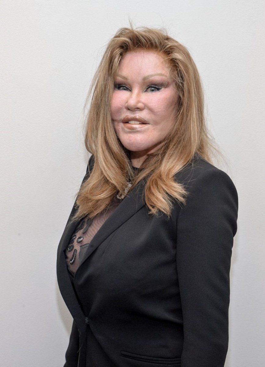 Jocelyn Wildenstei estetik masrafları yüzünden iflas etti