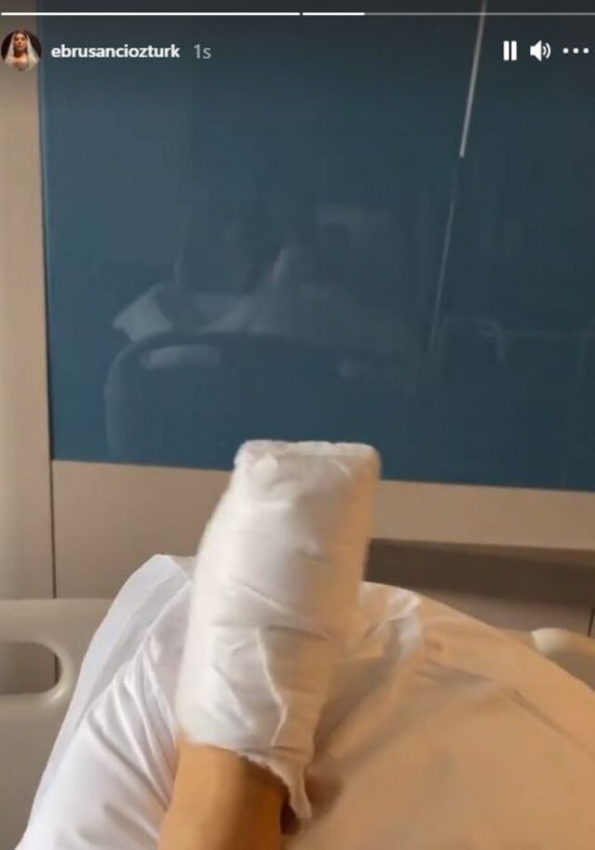 Ebru Şancı ayak parmağını kırdı